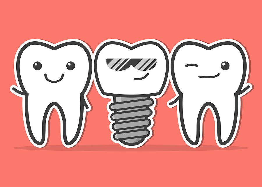 Transform Your Smile with Implants in Almaden, CA