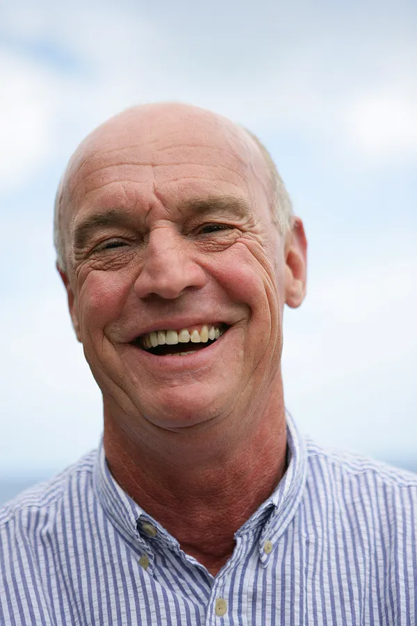 Dental Implants vs. Traditional Dentures in Almaden CA: Why Seniors Prefer the Game Changer