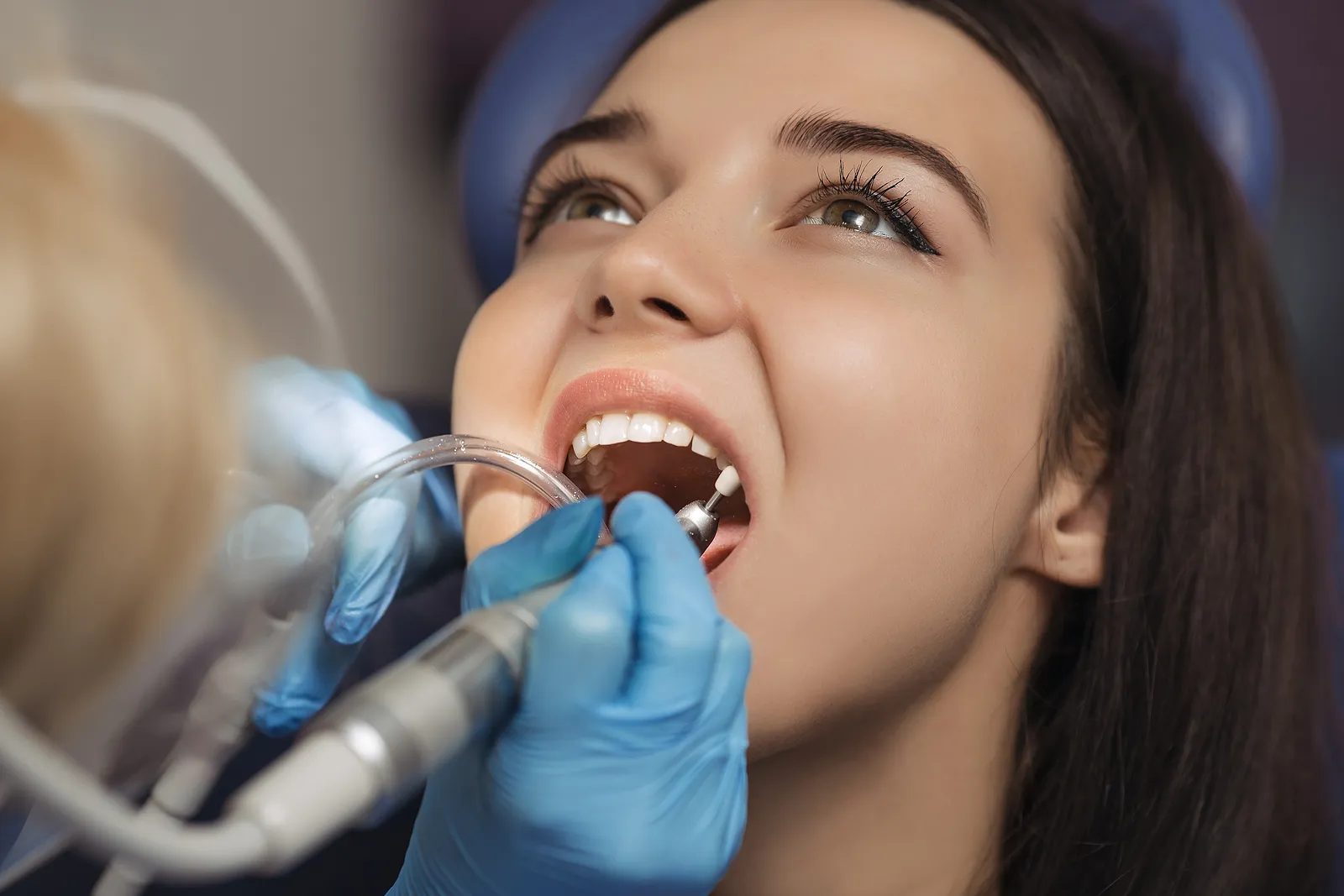 The Importance Of Preventative Dentistry in Almaden CA: How Regular Checkups And Cleanings Can Keep Your Smile Healthy